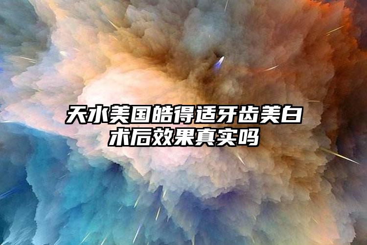 天水美国皓得适牙齿美白术后效果真实吗