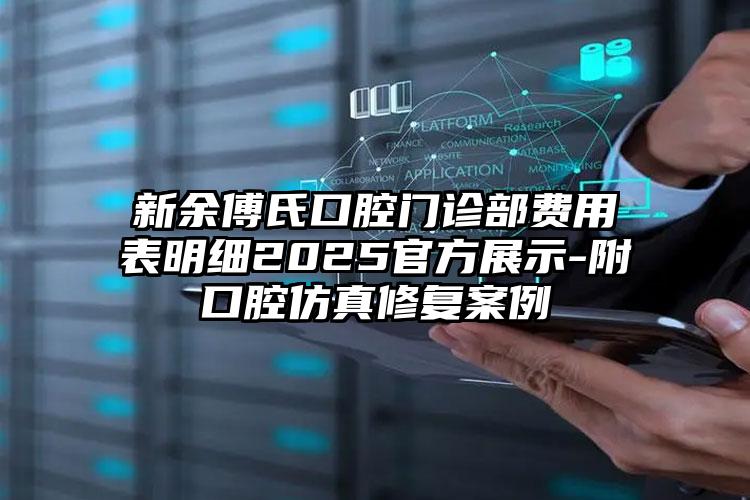 新余傅氏口腔门诊部费用表明细2025官方展示-附口腔仿真修复案例